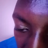 รูปโปรไฟล  ์ของ DICLOFENAK