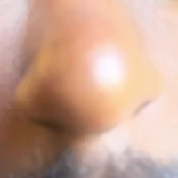 niclisrt