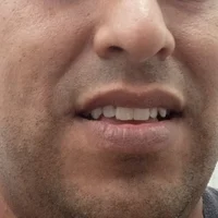 Elnegropija26s profilbillede