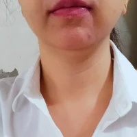 Ảnh Đại Diện YuraHen