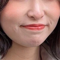 Gambar Profil ANJUJU-ZZ