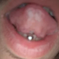 EttoreTrez