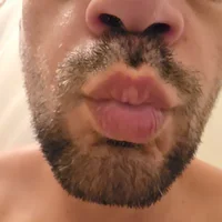 Me5454