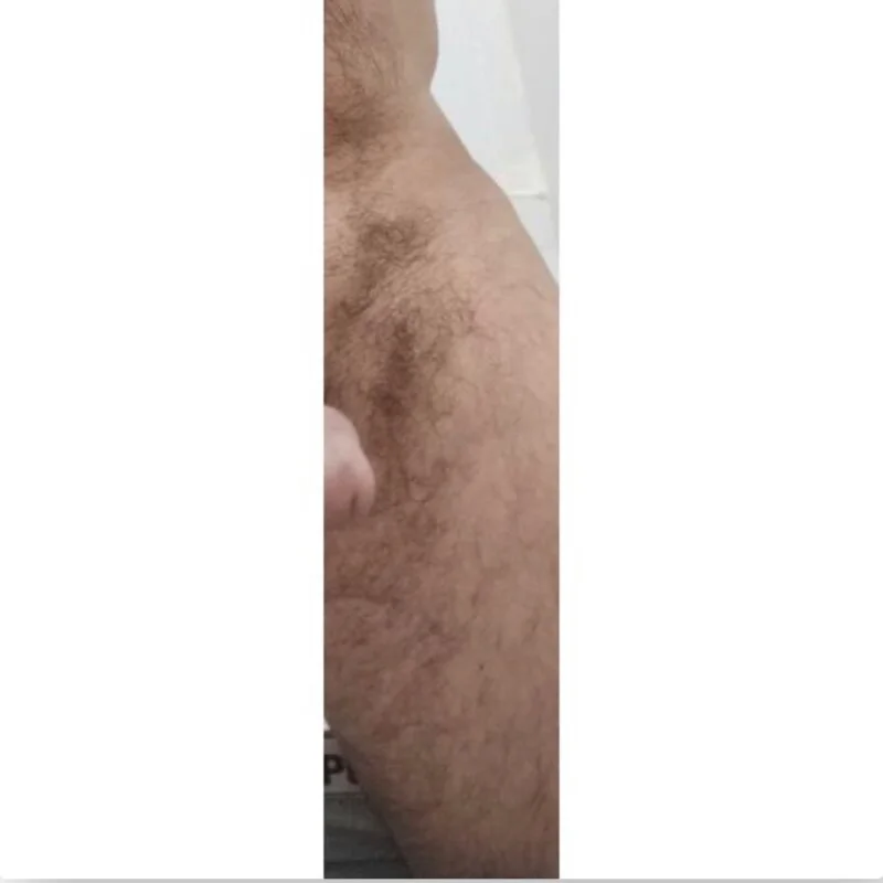 Profesyonelsikici38 profile photo