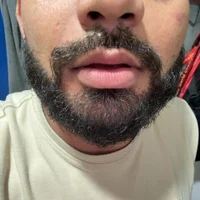 Cadeirante32s profilbillede