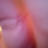 teeendicj