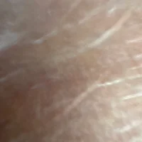 jungerspritzer55