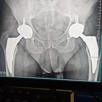 _Ember_ 아바타 사진