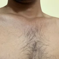 HairyR