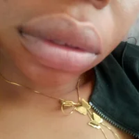 Yoursalobe's Profile Pic