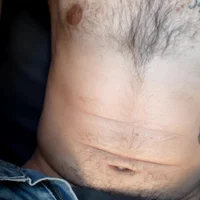 รู ปอวาตาร์ของ fg7318