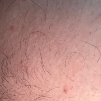 phussylover