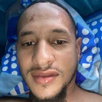 IctalAbscess