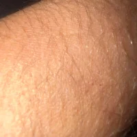 mlodydicknapalony