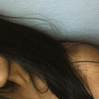 allerquina
