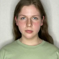 ChlloeKing - Profil Fotoğrafı