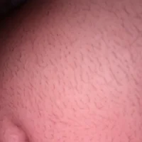 xxxxxxxxxxxxxcxxxxxxxxx