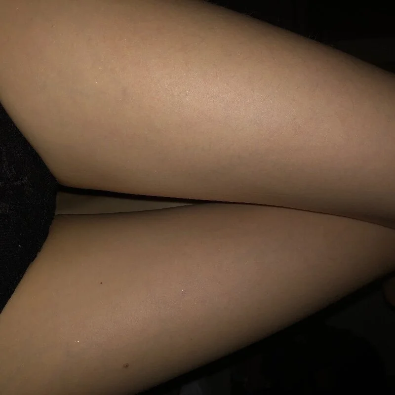 redlollita