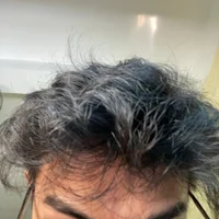Anbartoocum 的个人资料图片