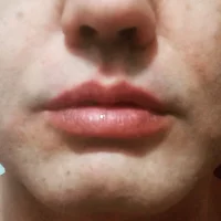 Ảnh Đại Diện Barao_Melado