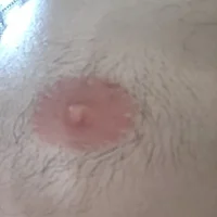 TommoT69