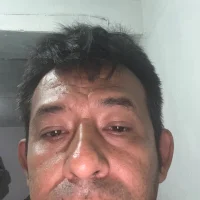 hectomas