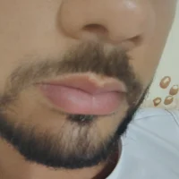 leofogo