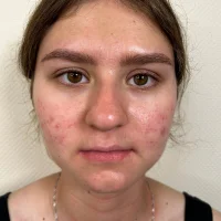 OttilieBows profilbillede