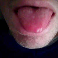 Imagem de avatar de openlegsforyou