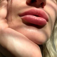 Gambar Profil Nofacemodel