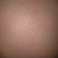 samotnyNapalony@xh