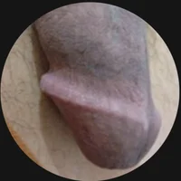 BigEcock10inches