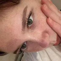 AstraVeins Profilfoto