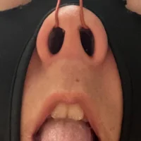 nosehook