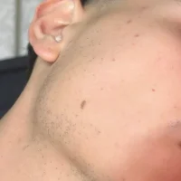 zyxizz