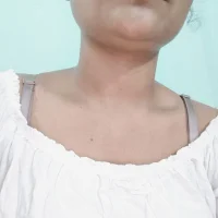 Nitaraa Poză de profil