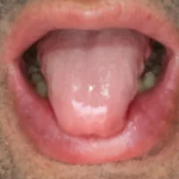 Fofinho44 avatarbilde