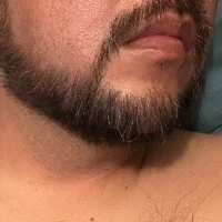 POXmx