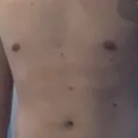 GhostedEditing