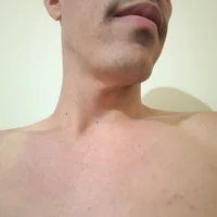 Novato2