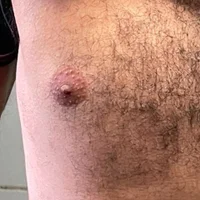 zezinhopravoce's Profile Pic