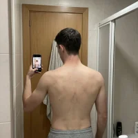 PoweredVitiligo avatarbilde