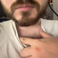 FrenchHairy760