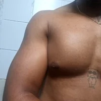 Gambar Profil VitiligoPeniano