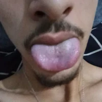 Iyhuooo