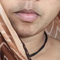 Poonamhote