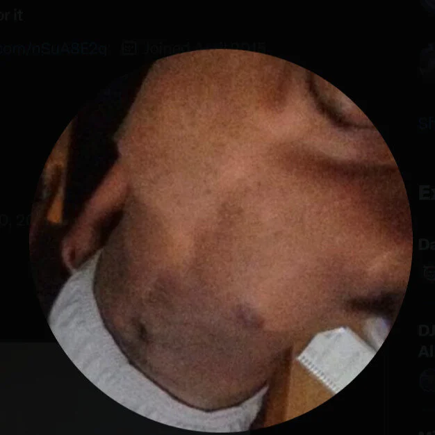 theveinzilla profile photo