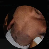 theveinzilla profiképe