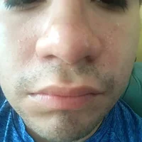 Foto do avatar de TroubledHeater30