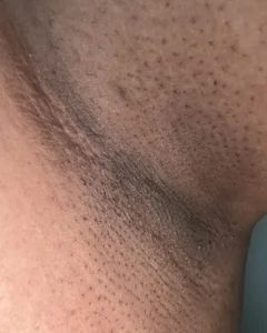 ashishs1207 Free lollipops Εικόνα